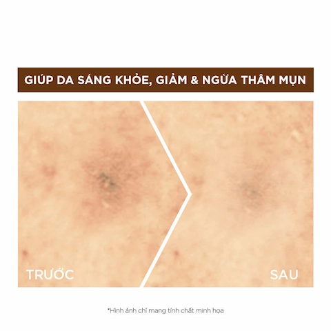 Tinh Chất Garnier Tăng Cường Sáng Da Mờ Thâm Ban Đêm 10% Vitamin C - Bright Complete Overnight Serum 30ml