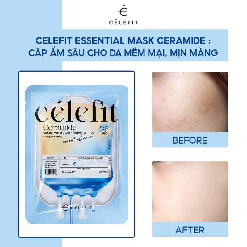 Mặt Nạ Celefit Essential Mask 23g - Ceramide