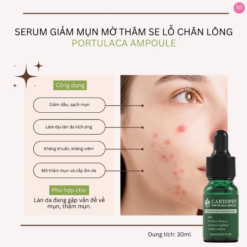 Tinh Chất Trị Mụn Caryophy Giảm Mụn Mờ Thâm Se Lỗ Chân Lông Portulaca Ampoule 30ml