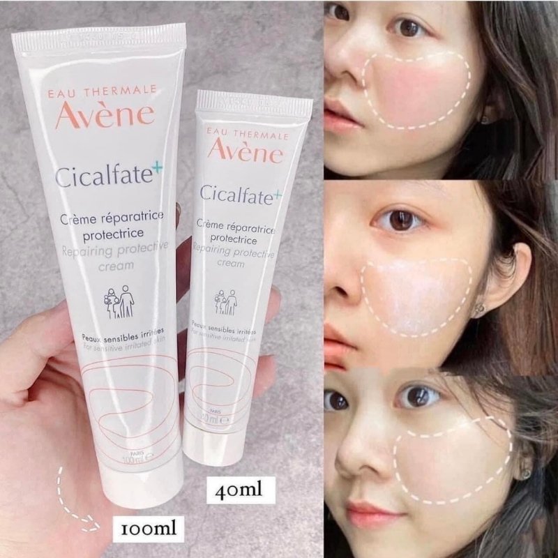Kem Phục Hồi Da Liền Sẹo Avene Cicalfate Cream (Nhập Khẩu) (Mẫu Mới) - 100ml