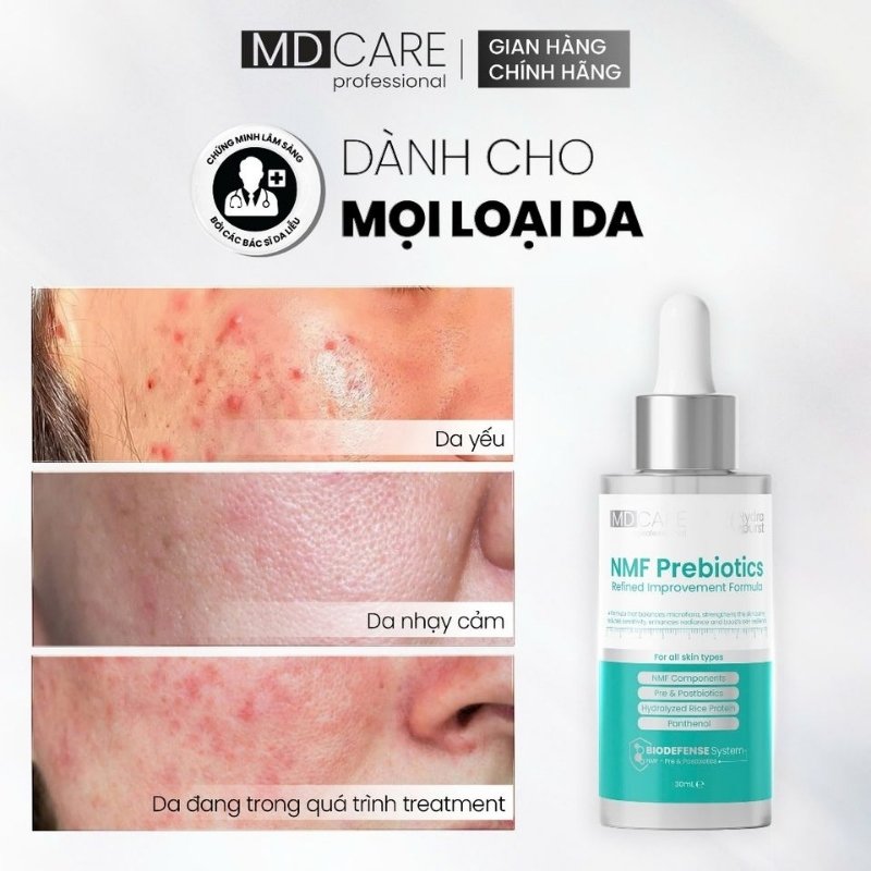 Tinh Chất Cân Bằng Lợi Khuẩn, Phục Hồi Da MD Care NMF Prebiotics 30ml