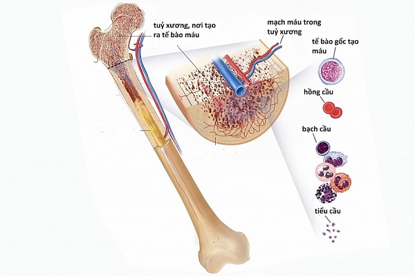 Suy tủy xương: Nguyên nhân, triệu chứng và cách điều trị