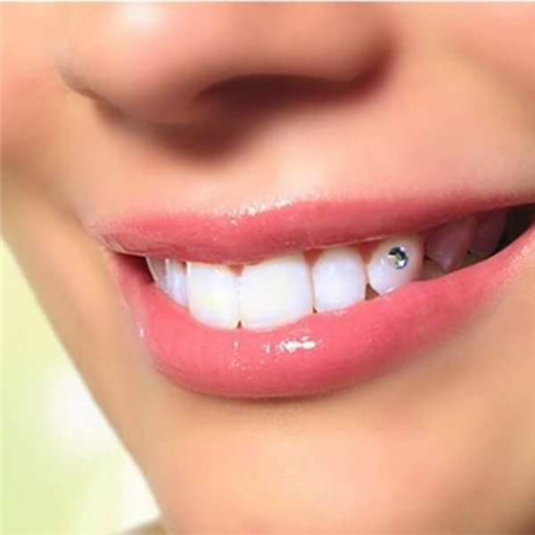 Tạo răng khểnh| Đính đá kim cương thẩm mỹ| An toàn không đau
