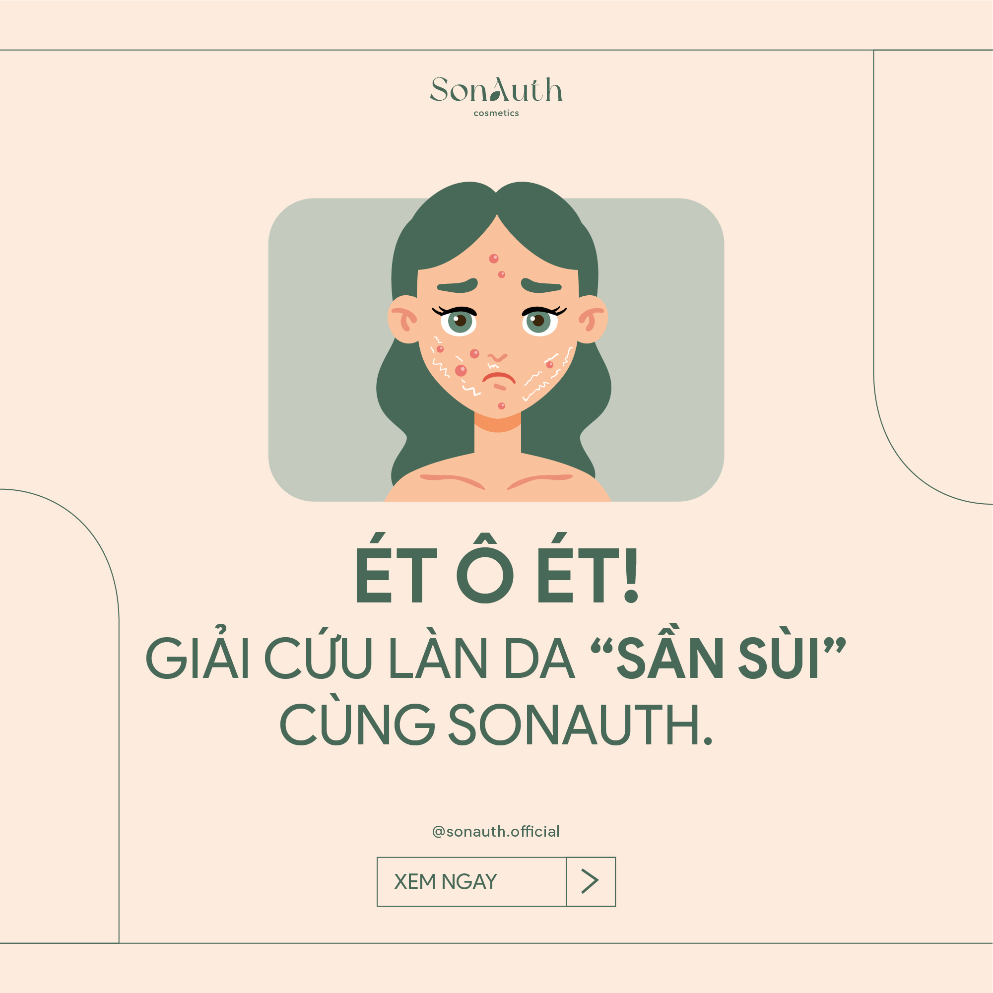 ÉT Ô ÉT! GIẢI CỨU LÀN DA “SẦN SÙI” CÙNG SONAUTH ÉT Ô ÉT! GIẢI CỨU LÀN DA “SẦN SÙI” CÙNG SONAUTH