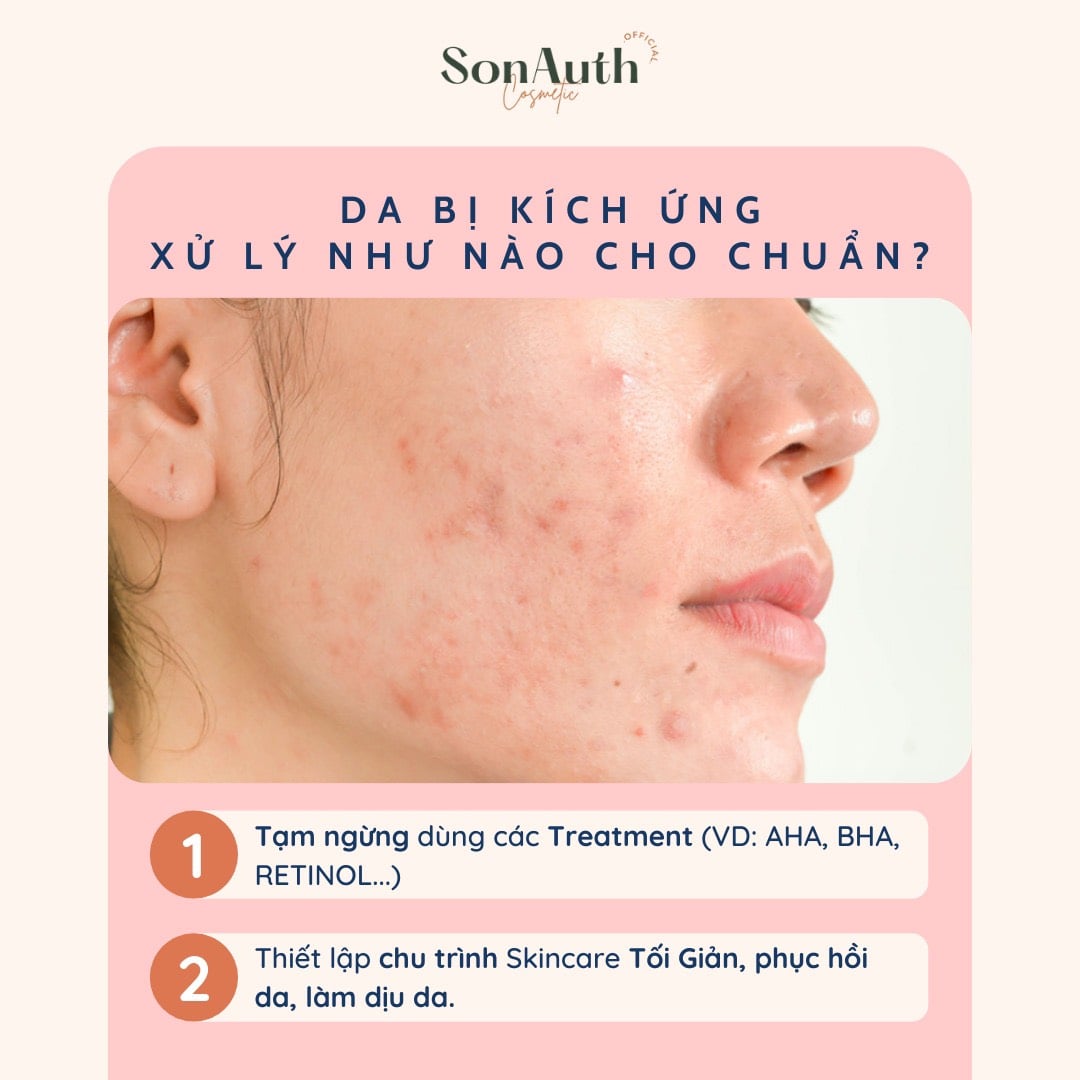 SkinCare101: Routine giải cứu làn da bị kích ứng ~