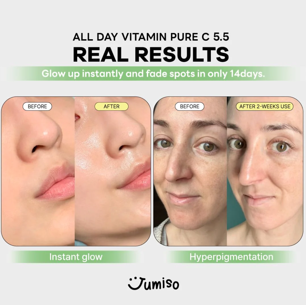 Tinh Chất Jumiso All Day Vitamin Pure C 5.5 Glow Serum 30ml