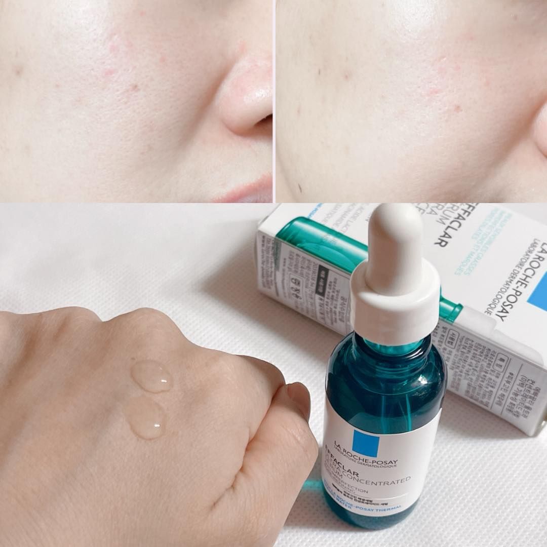 Tinh Chất La Roche-Posay Effaclar Ultra Concentrated Serum 30ml