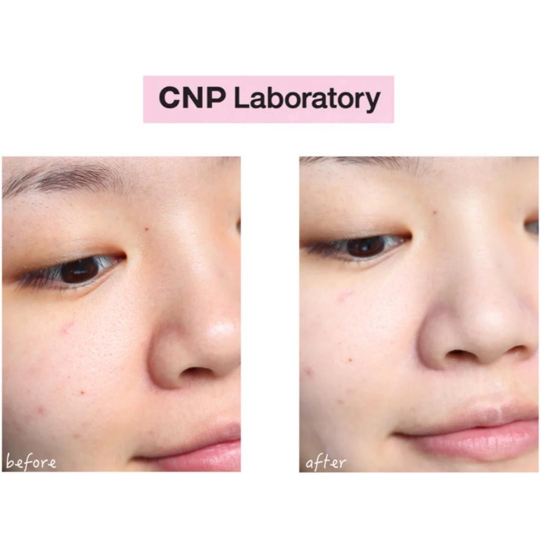 Bộ Dưỡng Da CNP Tone Up Special Set