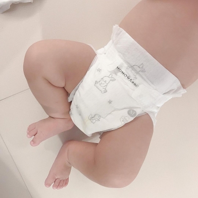 Mẹ nên chọn bỉm gì cho bé để không bị hăm?