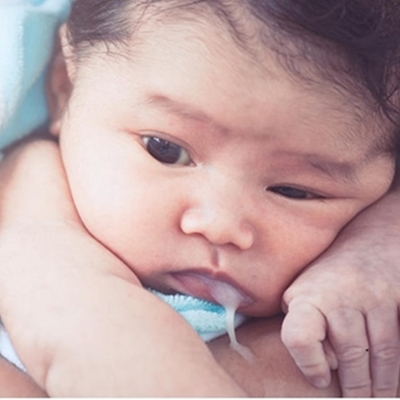 Những điều cần biết về nôn trớ ở trẻ sơ sinh