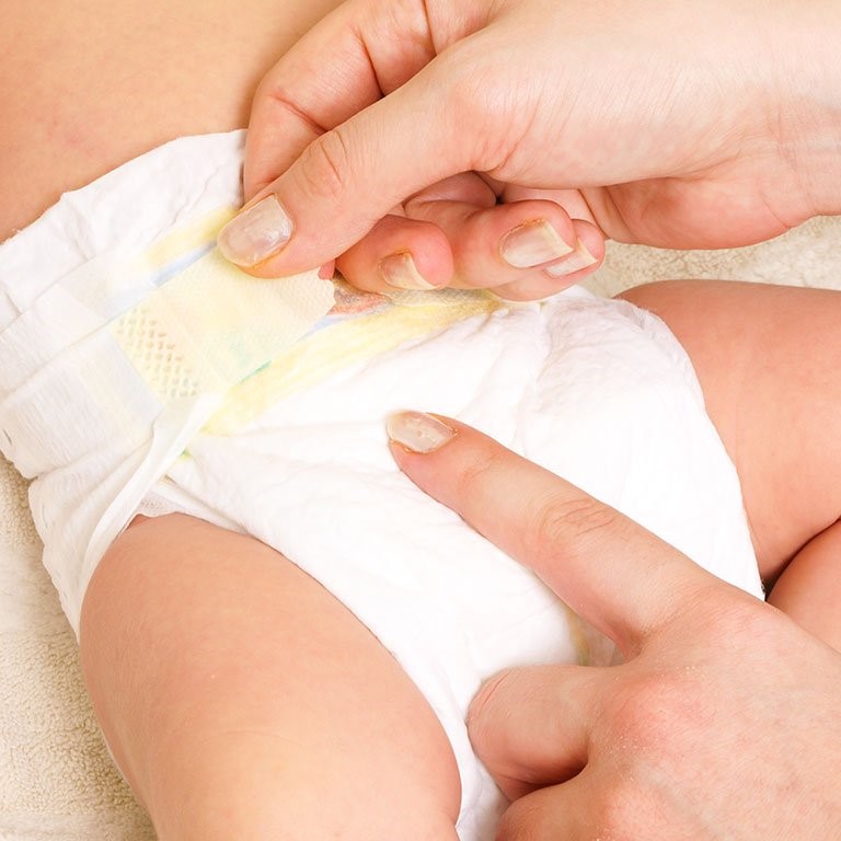 Hướng dẫn mẹ cách dùng tã dán sơ sinh 