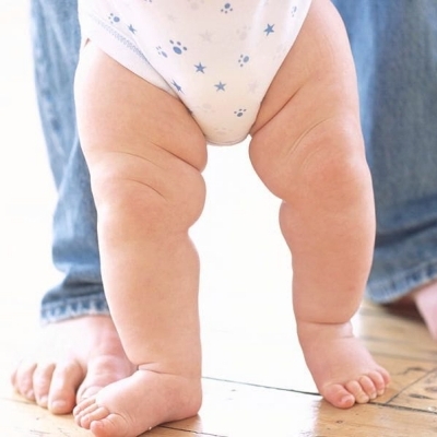 Bé chậm biết đi? “Thủ phạm” là bỉm xệ, vón cục!