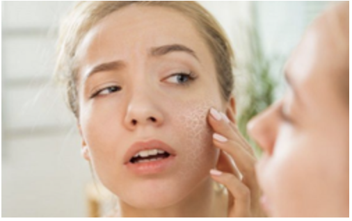 Da mặt khô làm gì để cải thiện?