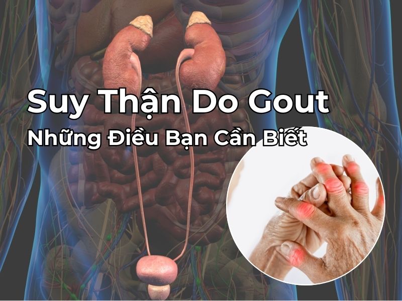 Suy Thận Do Gout - Những Điều Bạn Cần Biết