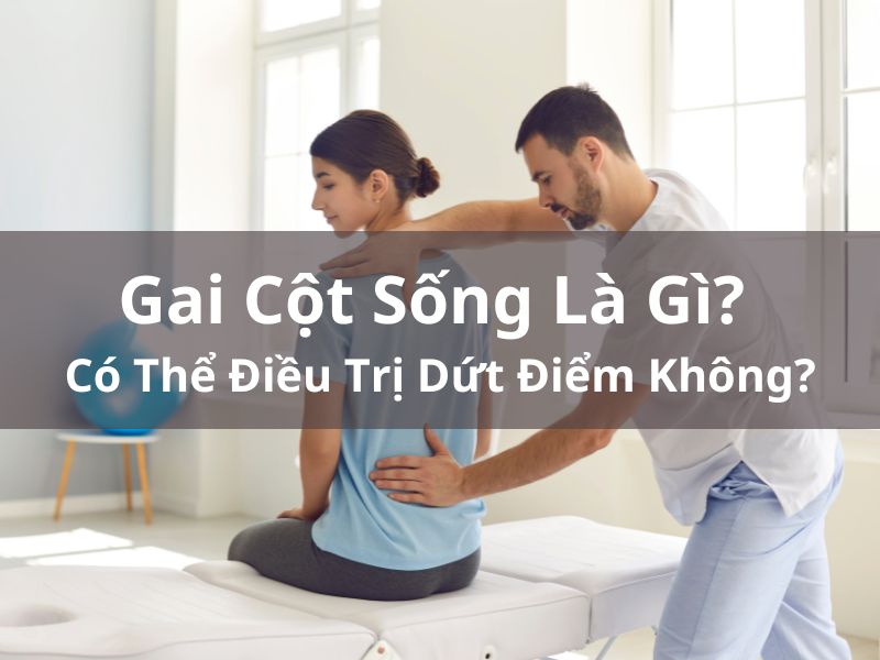 Gai Cột Sống Là Gì? Có Thể Điều Trị Dứt Điểm Không?