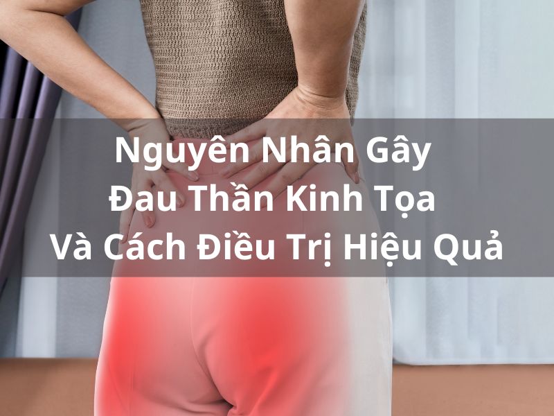 Nguyên Nhân Gây Đau Thần Kinh Tọa Và Cách Điều Trị Hiệu Quả