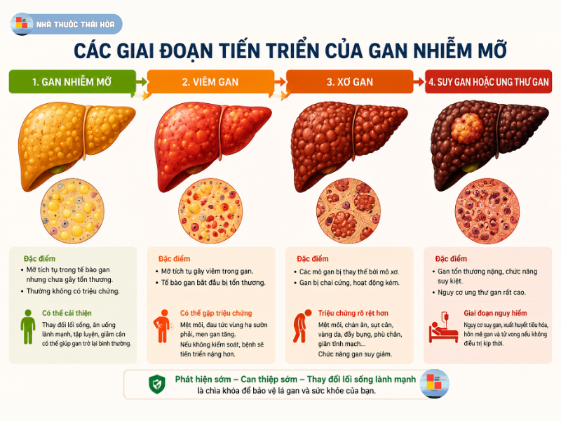 Các giai đoạn tiến triển của Gan nhiễm mỡ