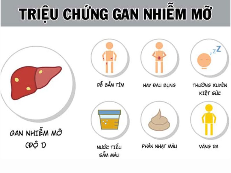 Triệu chứng của bệnh gan nhiễm mỡ