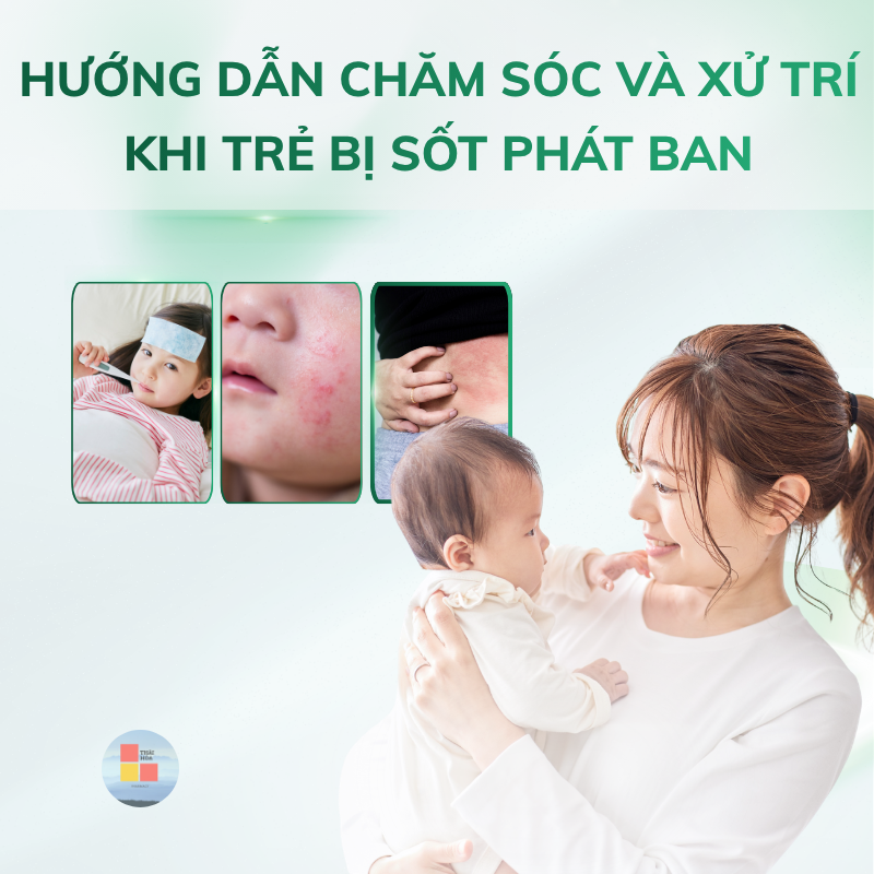 Hướng dẫn chăm sóc bé khi bị sốt phát ban