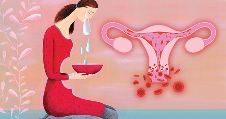 Phụ nữ sau sảy thai – Khẩn trương ôn ấm lại tử cung lạnh