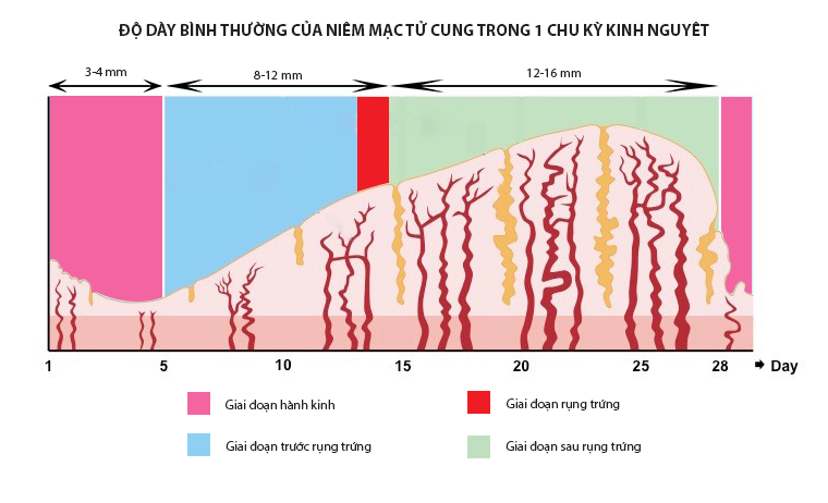 Niêm mạc tử cung lý tưởng để thụ thai