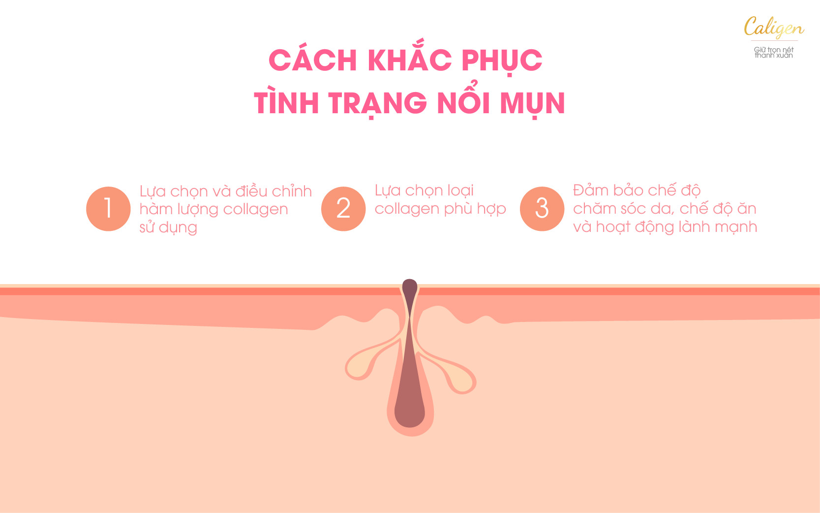 Cách khắc phục tình trạng nổi mụn