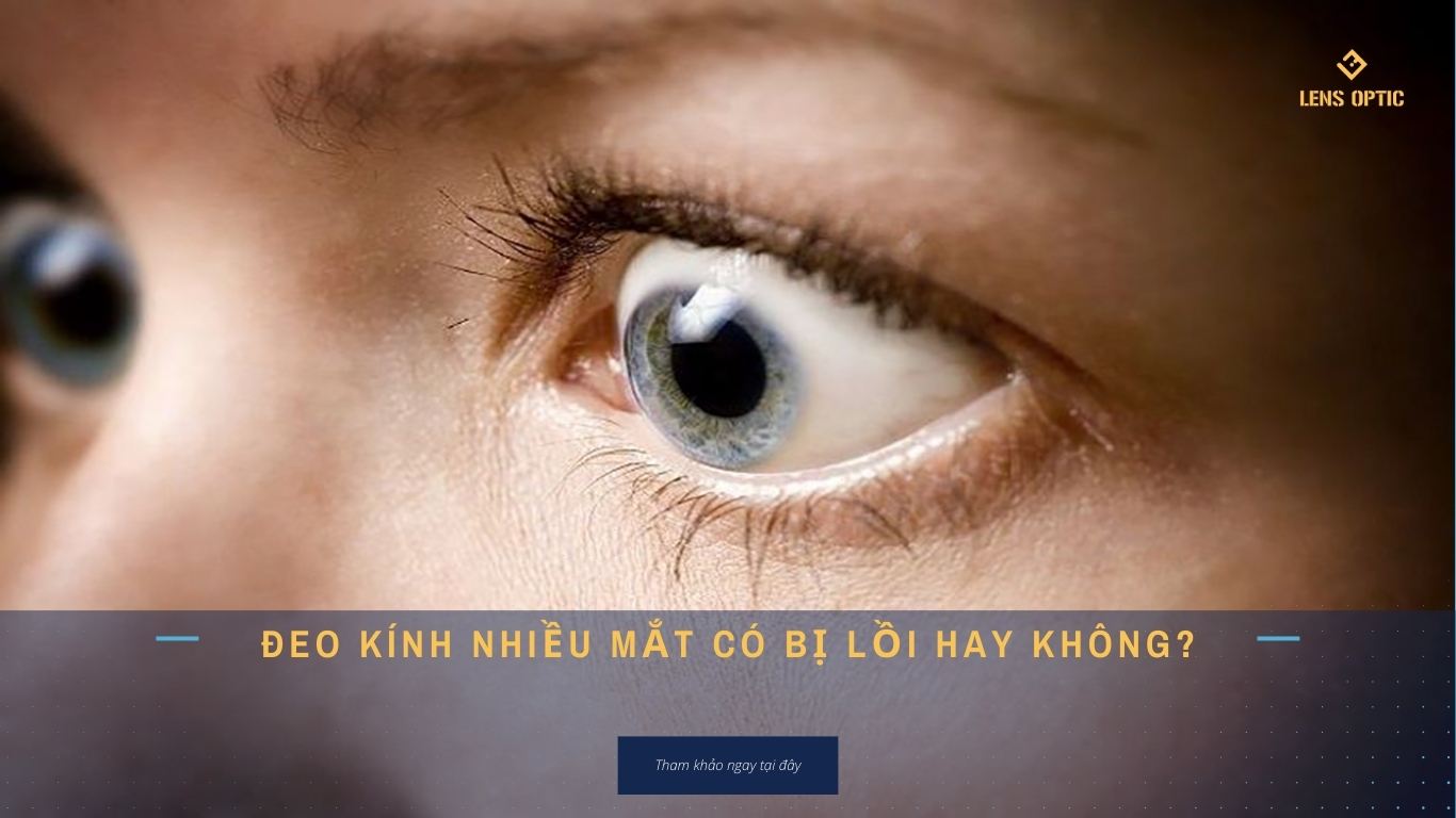 ĐEO KÍNH NHIỀU MẮT CÓ BỊ LỒI HAY KHÔNG?