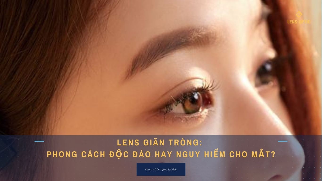 LENS GIÃN TRÒNG: PHONG CÁCH ĐỘC ĐÁO HAY NGUY HIỂM CHO MẮT?