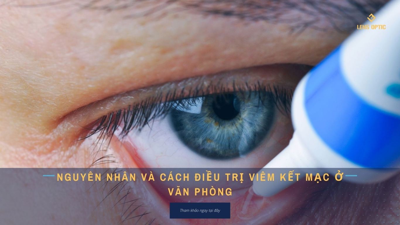 NGUYÊN NHÂN VÀ CÁCH ĐIỀU TRỊ VIÊM KẾT MẠC Ở VĂN PHÒNG