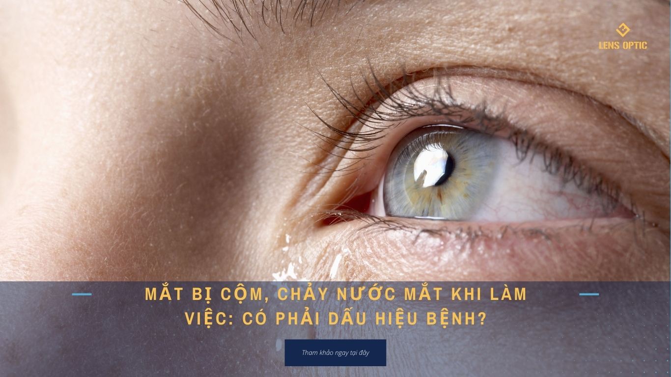 MẮT BỊ CỘM, CHẢY NƯỚC MẮT KHI LÀM VIỆC: CÓ PHẢI DẤU HIỆU BỆNH?