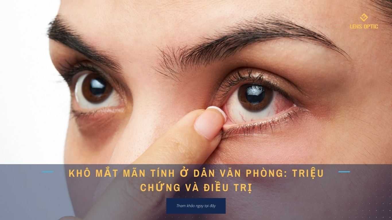 KHÔ MẮT MÃN TÍNH Ở DÂN VĂN PHÒNG: TRIỆU CHỨNG VÀ ĐIỀU TRỊ