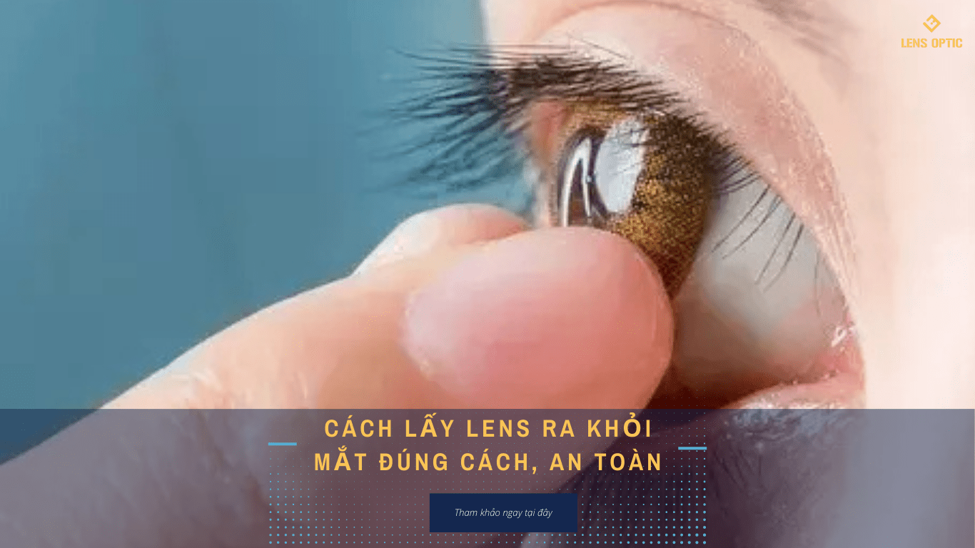 Cách Lấy Lens Ra Khỏi Mắt Đúng Cách Và An Toàn