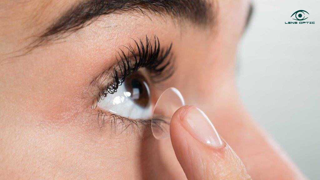 Kính áp tròng triều trị cận thị ban đêm và giải pháp hạn chế phát triển cận thị như thế nào?