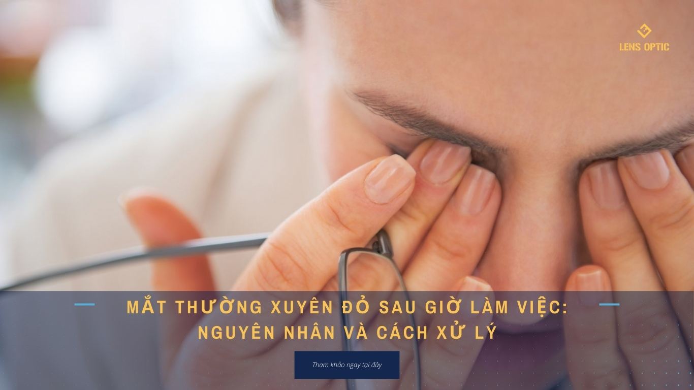 Mắt thường xuyên đỏ sau giờ làm việc: Nguyên nhân và cách xử lý
