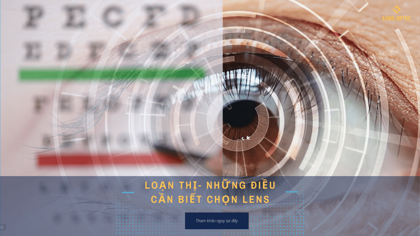Cách chọn lens cho mắt cận loạn: Hướng dẫn chi tiết từ chuyên gia