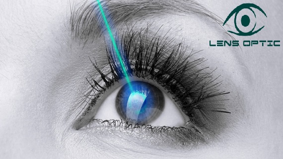Phẫu thuật LASIK là gì? Và các lưu ý cần biết trước và sau khi thực hiện phẫu thuật LASIK?