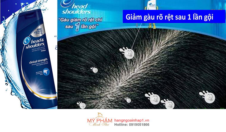 Dầu gội Trị gàu Head & Shoulders Clinical Strength (400ml) - Mỹ giúp da đầu sạch gàu. Với công nghệ Fresh Scent giúp tóc và da đầu trở nên khỏe mạnh, tóc chắc khỏe, bảo vệ và dưỡng ẩm da đầu.