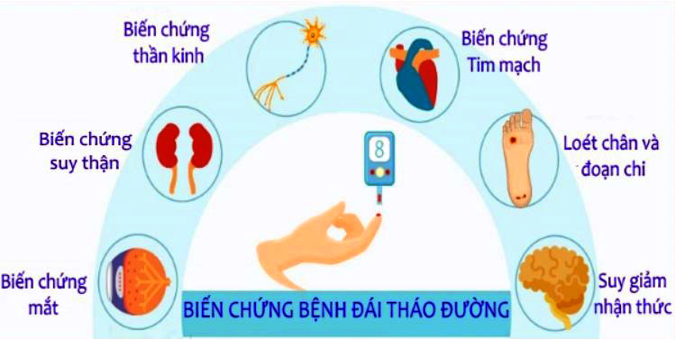 Bệnh đái tháo đường