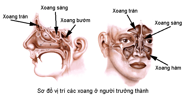 Viêm xoang nếu không được chữa trị và phòng ngừa hiệu quả sẽ dẫn đến tái phát nhiều lần và trở thành mạn tính