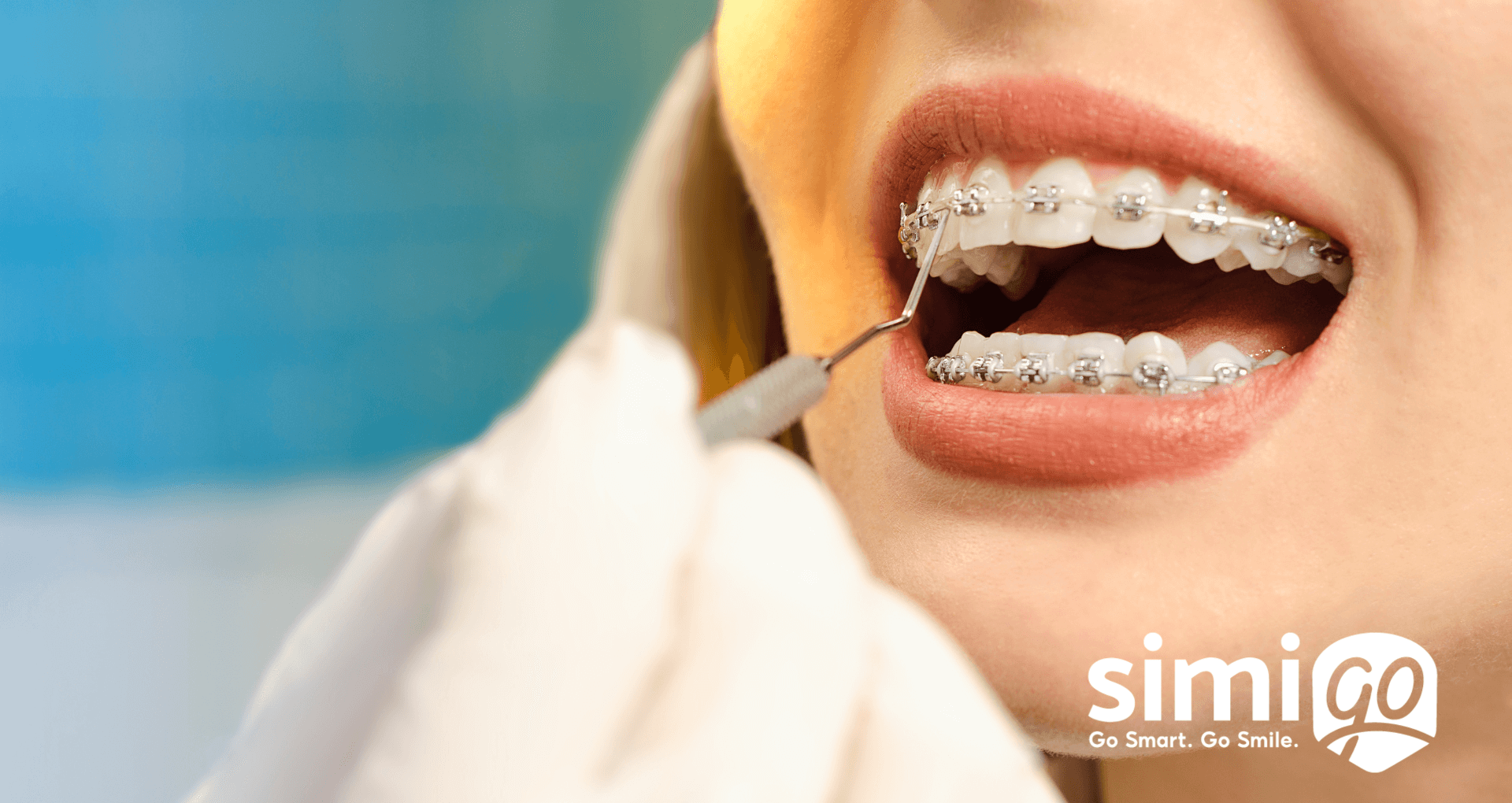 cach-cham-soc-rang-nieng-don-gian-moi-ngay