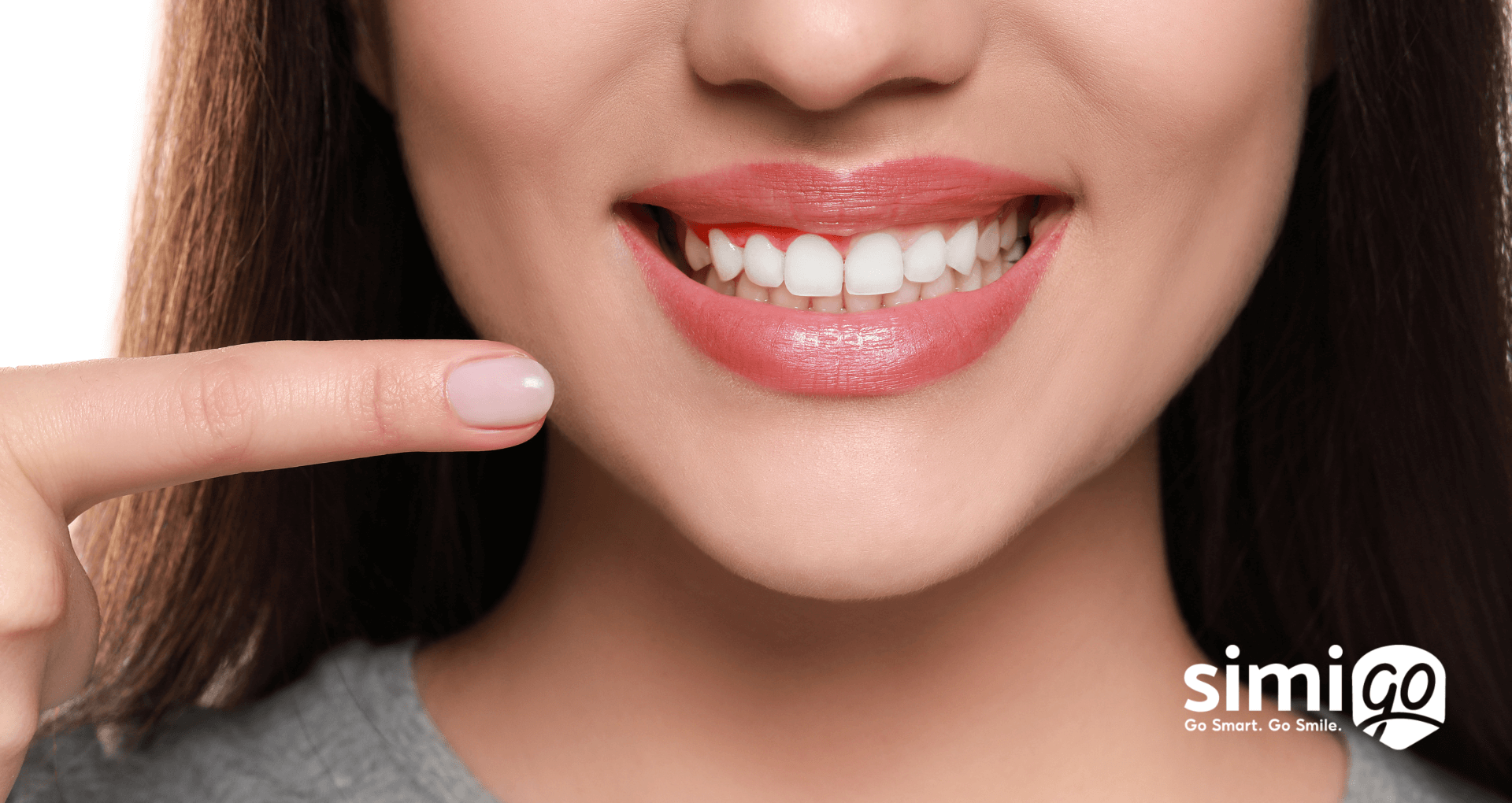 phong-ngua-va-dieu-tri-viem-nuou-rang-don-gian-ngay-tai-nha