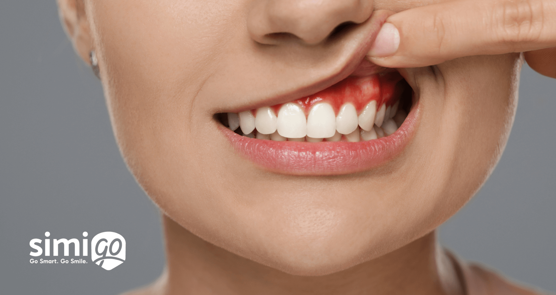 phong-ngua-va-dieu-tri-viem-nuou-rang-don-gian-ngay-tai-nha