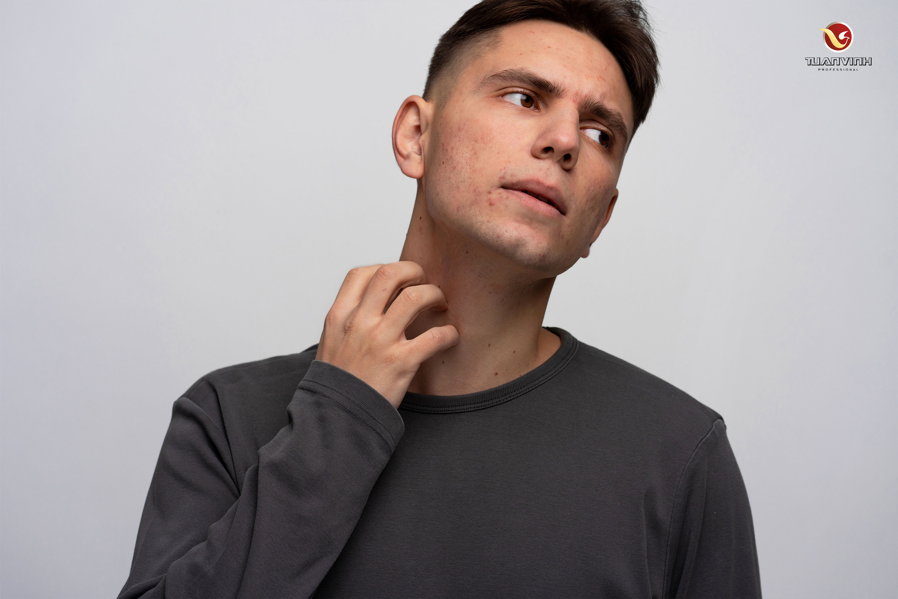 Sai lầm khi chăm sóc da mùa đông khiến phái mạnh bị kích ứng da