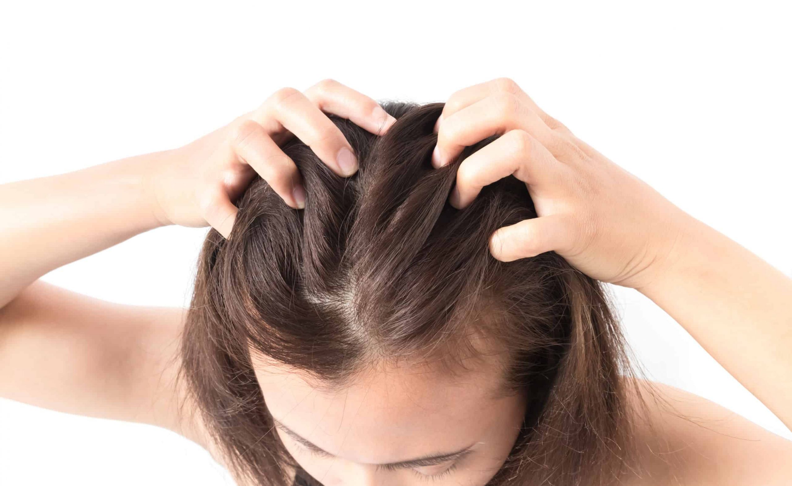 Gội đầu nhiều khiến tóc và da đầu càng dễ khô, và dầu tiết ra càng nhiều hơn (Nguồn ảnh: Internet)