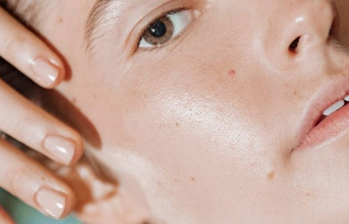 PEEL DA TRỊ MỤN CÓ TỐT KHÔNG CẦN LƯU Ý NHỮNG GÌ 