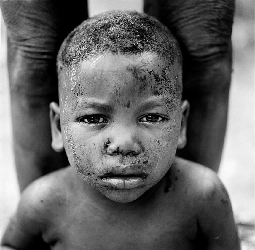 Rợn người trước hủ tục “rạch mặt” trẻ em ở Tây Phi