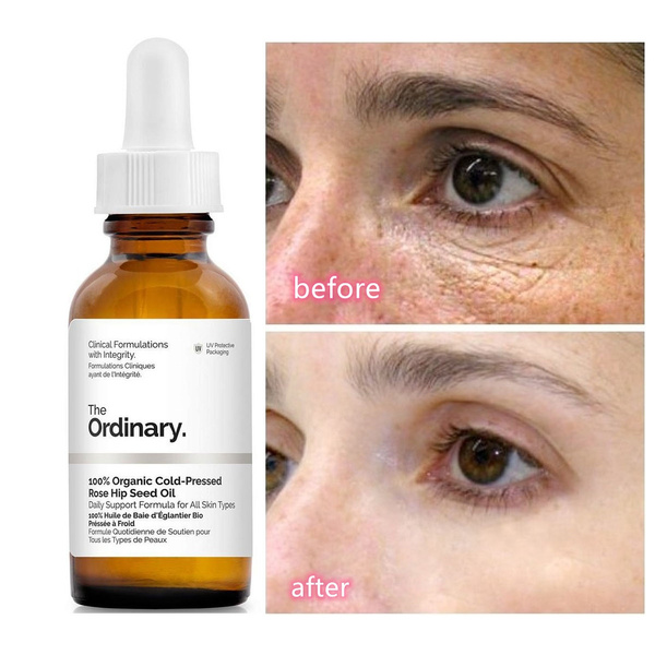 Serum Dưỡng Mắt The Ordinary Caffeine Solution 5% + EGCG