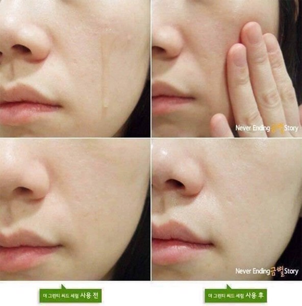 Tinh Chất Dưỡng Ẩm Sâu, Phục Hồi Da Mụn Innisfree Green Tea Seed Serum