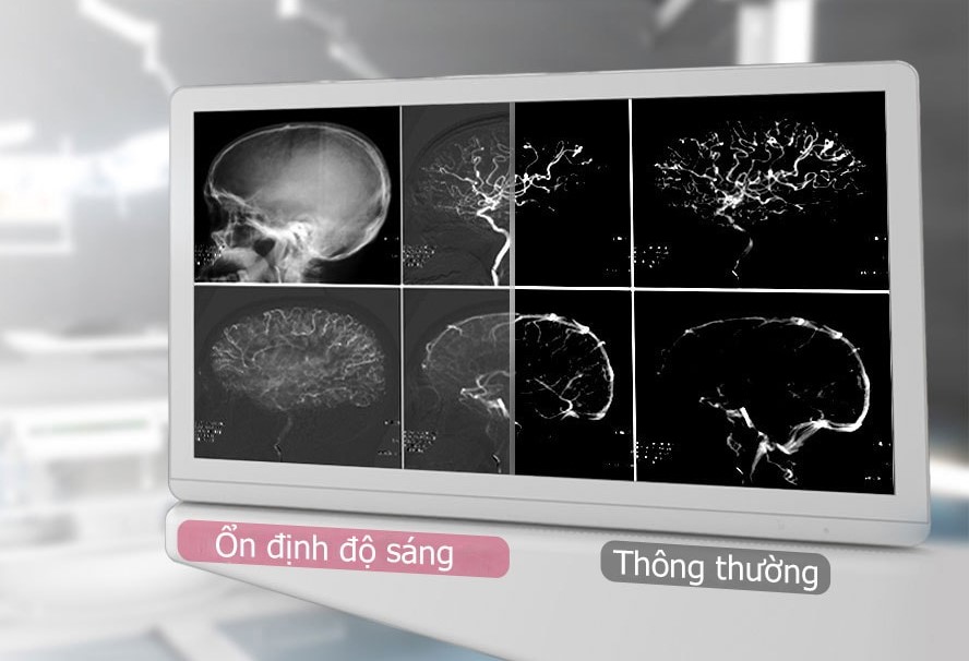 DICOM Part 14: Tiêu Chuẩn Hiển Thị Hình Ảnh Y Tế