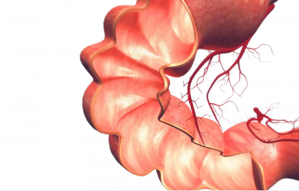 Bệnh viêm ruột liên quan đến ung thư tuyến tiền liệt Bệnh viêm ruột liên quan đến ung thư tuyến tiền liệt